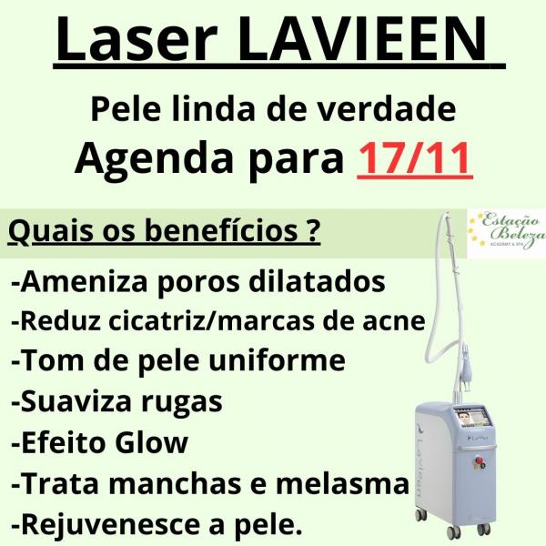 Laser day LAVIEEN