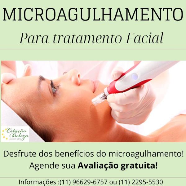 Microagulhamento 